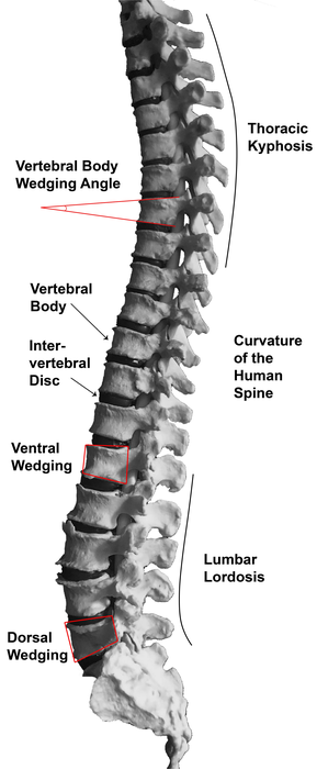 Spinal curvatures