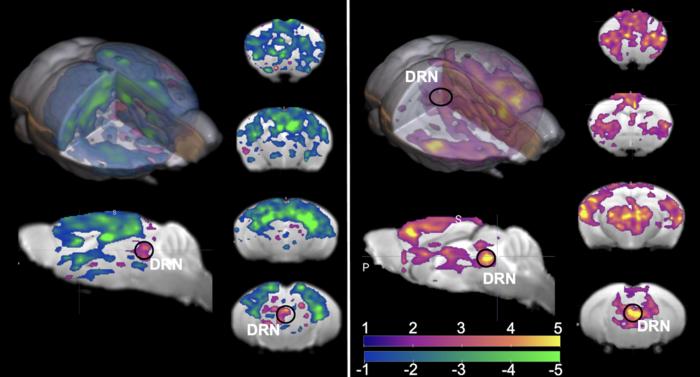 覚醒状態のマウスと麻酔状態のマウスにおける背側縫線核の活性化に対する脳の反応の比較