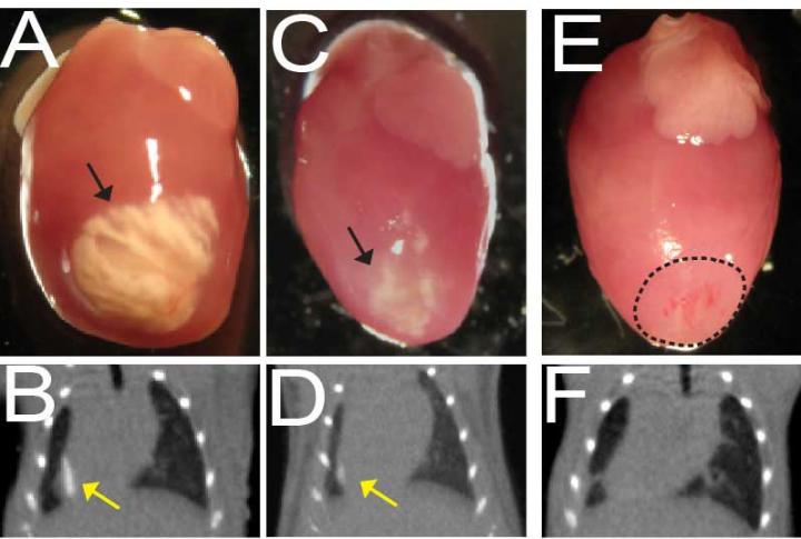 Calcium Deposits in the Mouse Heart
