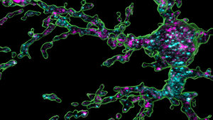 Oligodendrocyte precursor cells