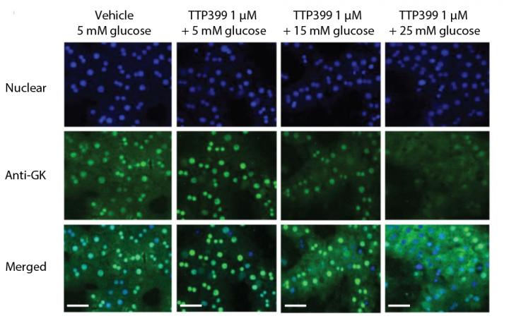 Cheering on a Potential Diabetes Drug from Bench to Bedside