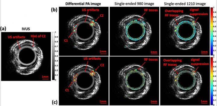 SPIE <em>Journal of Biophotonics</em>, Figure 11