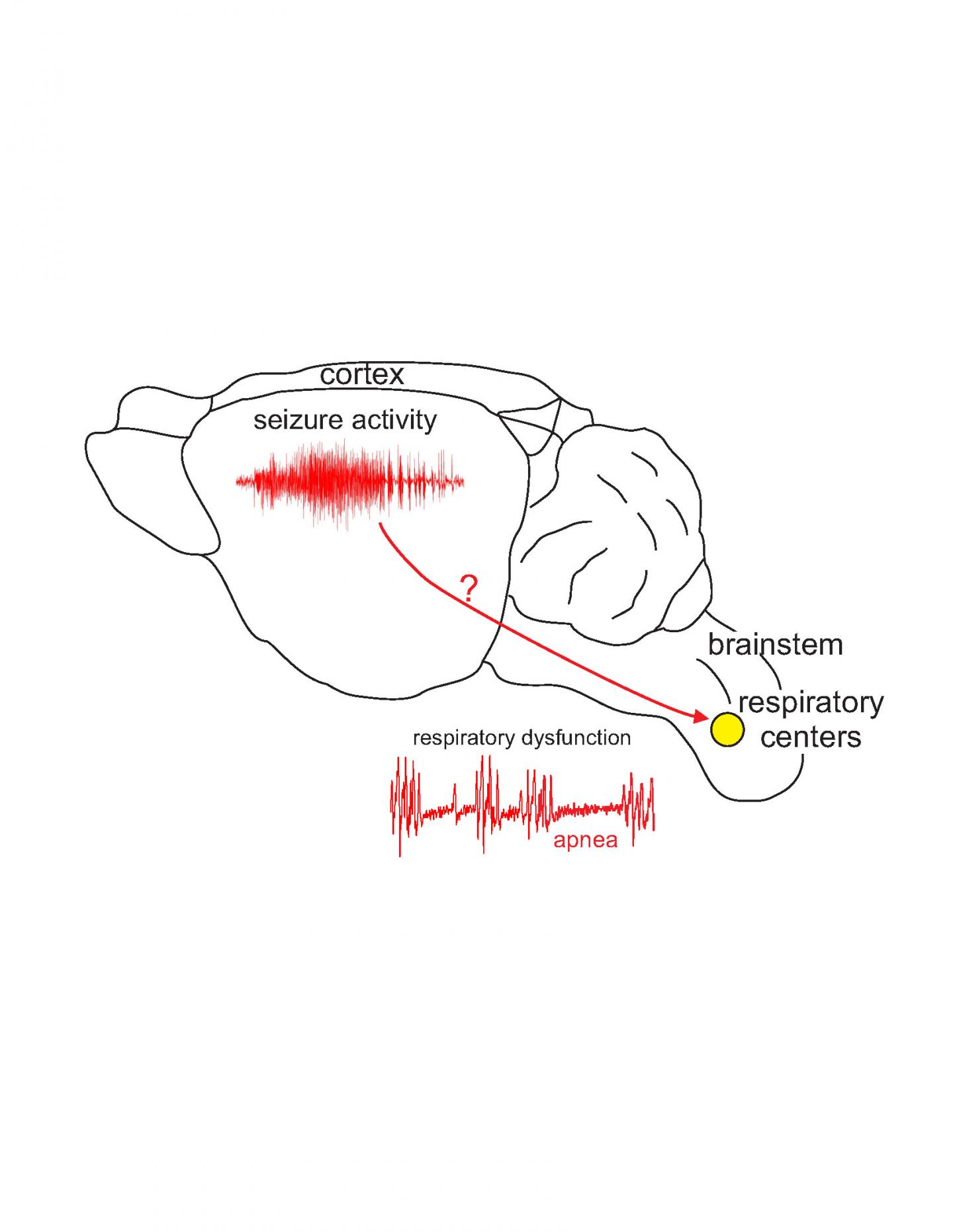 Sudden Death in Epilepsy: Do Seizures Travel From Cortex to Brainstem?