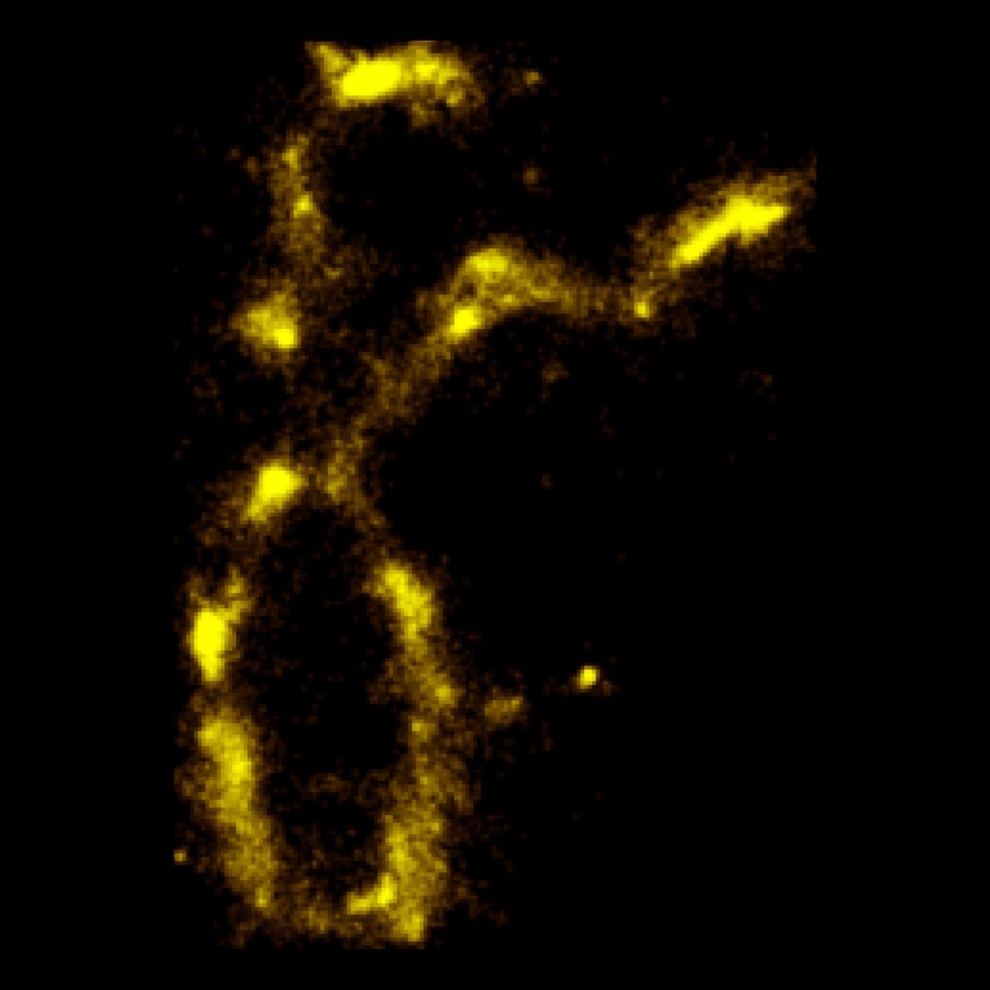 Chromosome Image