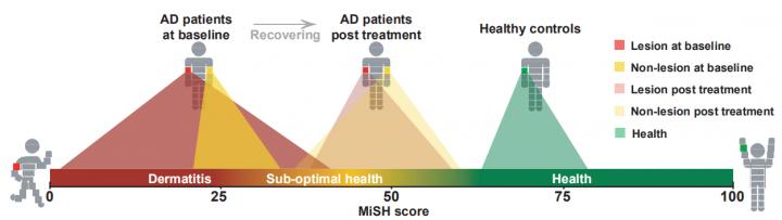 MiSH is a Universal Scale to Quantitatively Assess and Compare Skin-Health State via Skin Microbiota