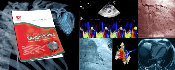 Bulgaria's National Cardiac Society's Journal Bulgarian Cardiology