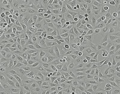 Vestibular Schwannoma Cells -- Untreated