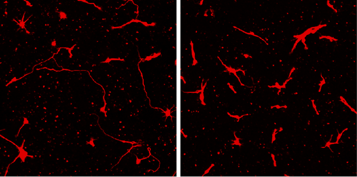 Differences in cells from a patient with pediatric bipolar disorder