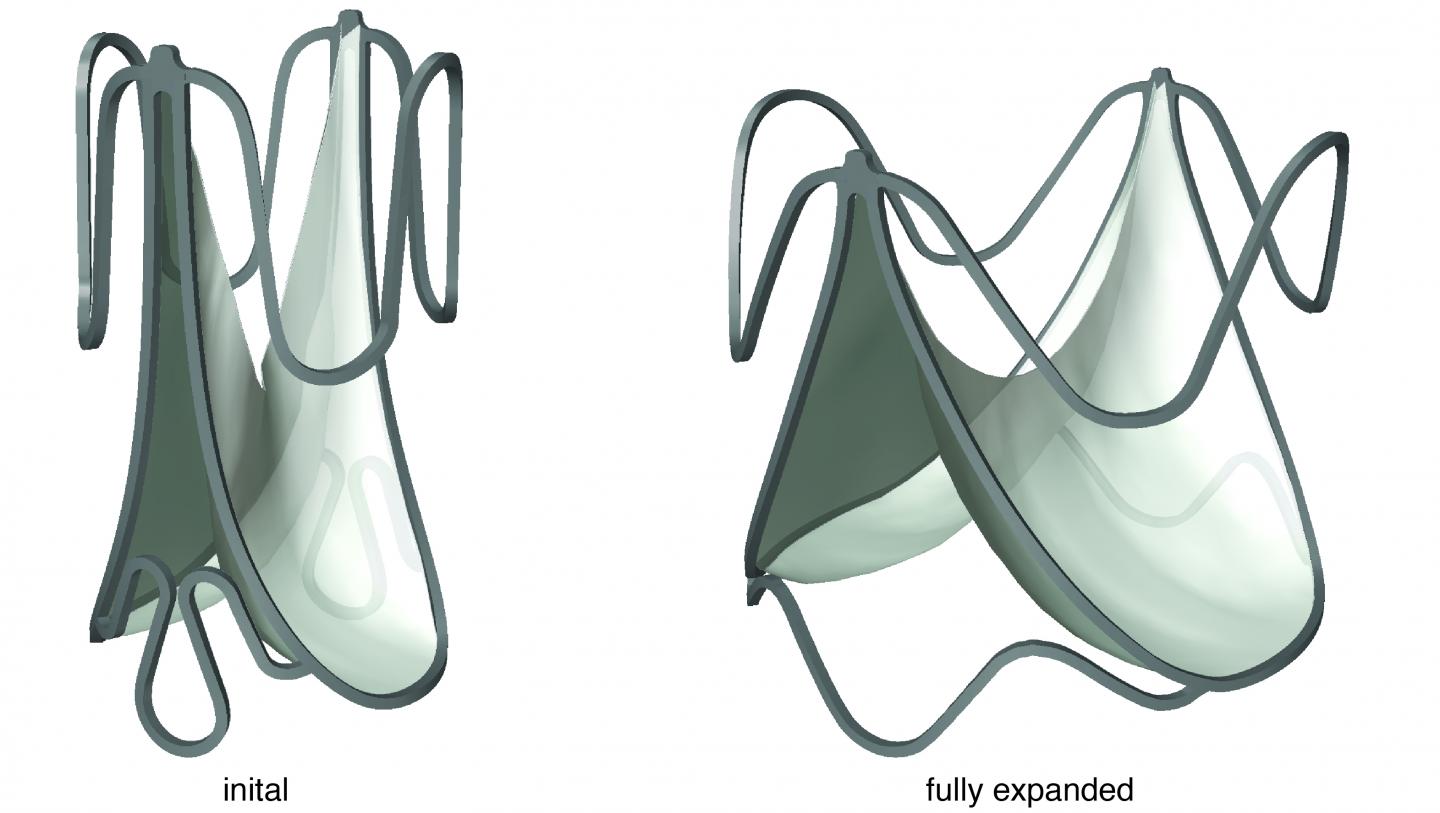 Size-Adjustable Prosthetic Heart Valve Accommodates Heart Growth in Sheep (3 of 8)