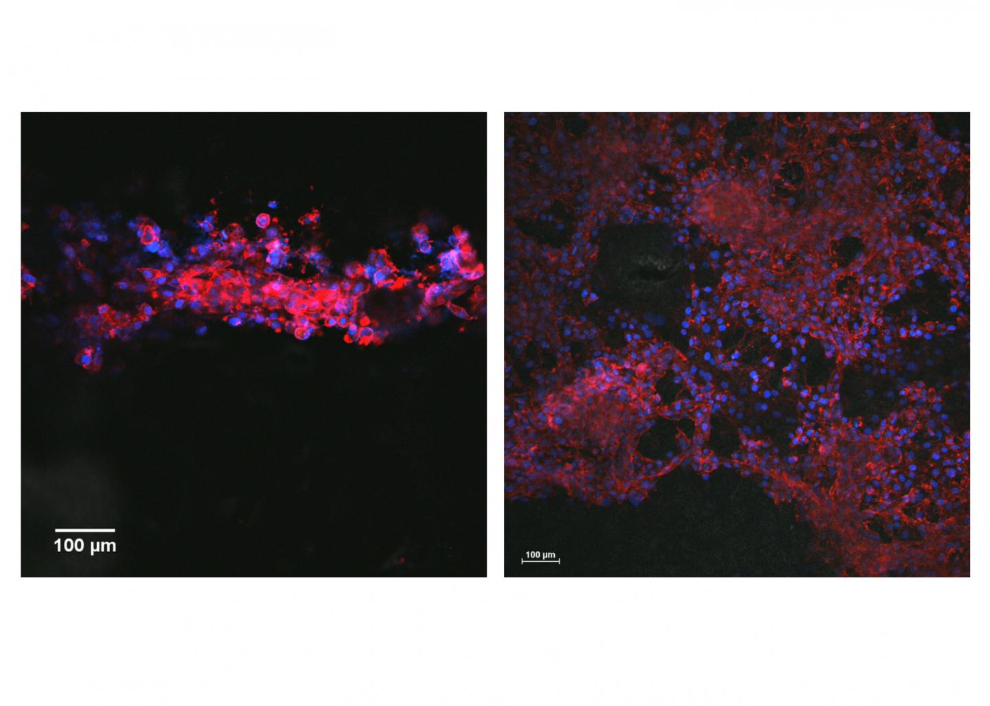 Neurons and bioconductive ink (side by side)