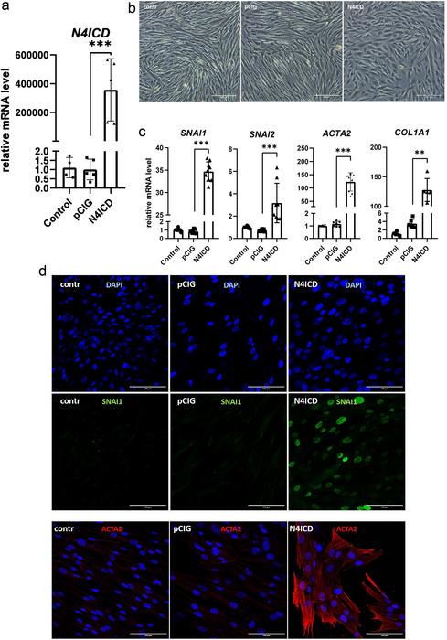 Induction of fibrogenesis-associated genes in human lung fibroblasts on day 3 after N4ICD transduction