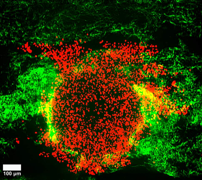 Tumour model