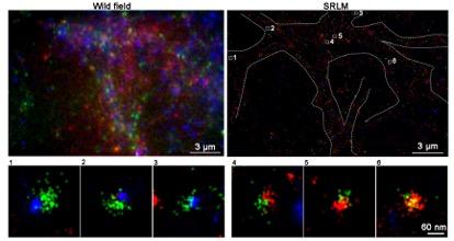 ATM and ATR Form Separate Synaptic Vesicle Patterns