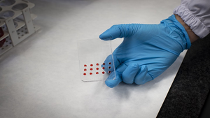 Researchers design a microfluidics physics-based device to predict cancer therapy response