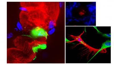 New Insights into How Leprosy Infection Spreads Could Pave the Way for Early Intervention