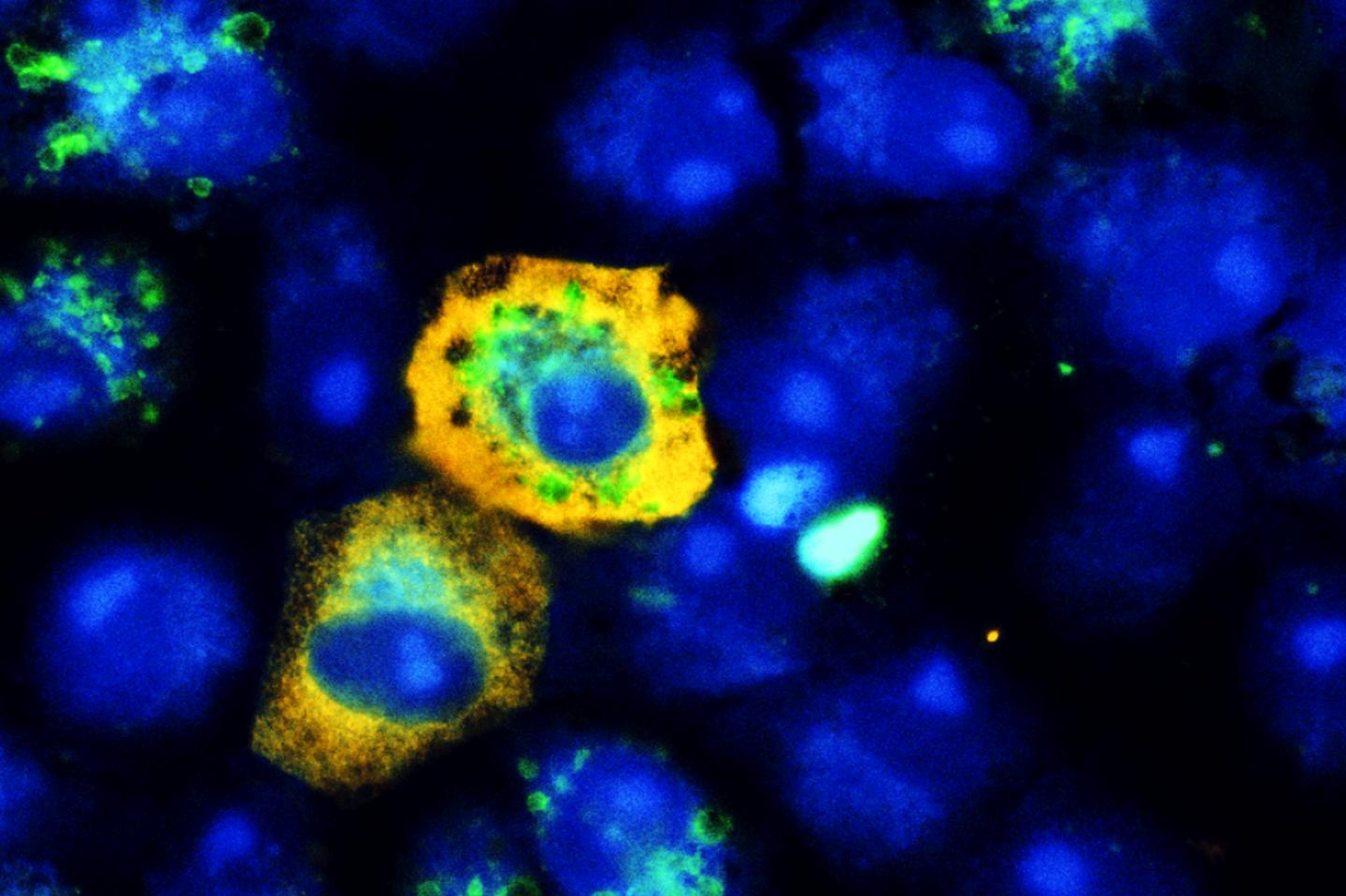 SARS-CoV-2 Infected Monkey Kidney Cells