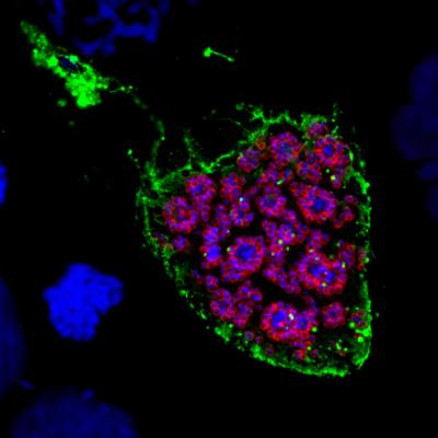 Malaria Parasite in liver cells