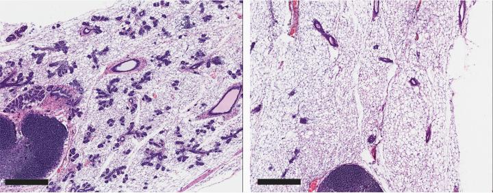 A Vulnerability in Stem Cells that Breast Cancer Cells May Share