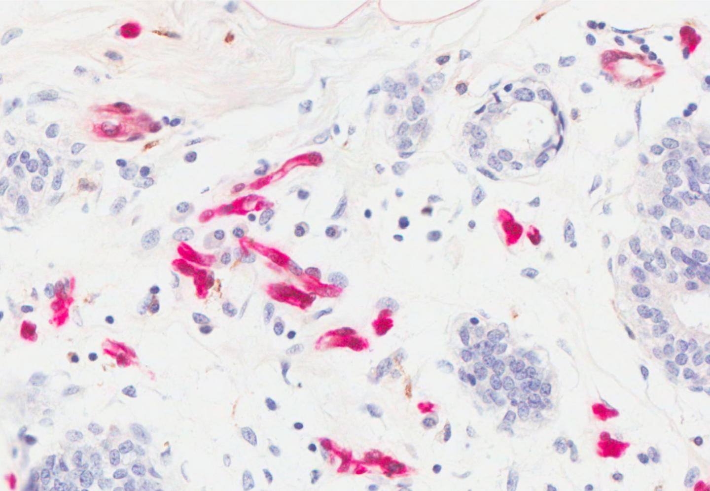 Adipose fatty acid binding protein (FABP4) in mammary glands