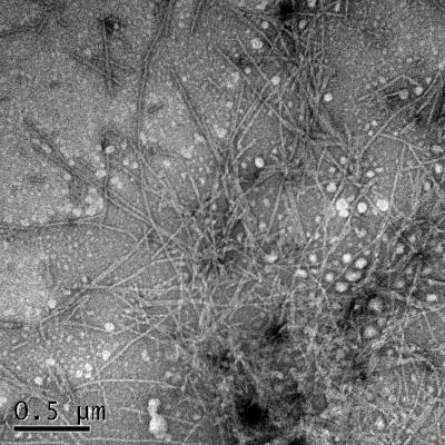 Transmission Electron Microscope Images of α-synuclein Aggregates