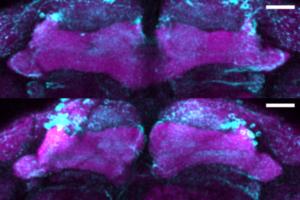 Synapse loss in aged mutant flies