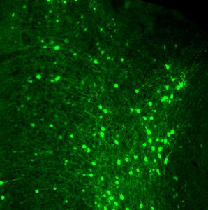 NTU Singapore study reveals new clues on how ageing alters brain cells’ ability to maintain memory