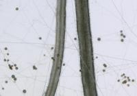 The Spores and Hyphae of 'Friendly' Fungi Interacting with Plant Roots