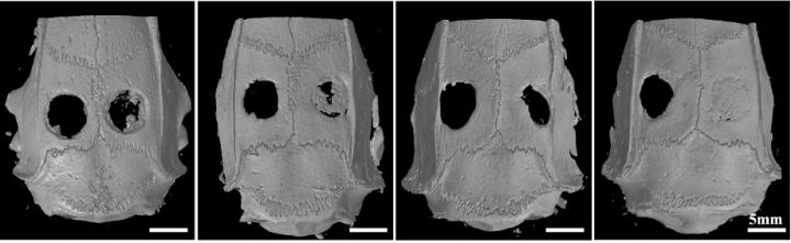 New 3D Bioprinting Technique Leads to Better Bone Formation and Defects Repair Efficiency