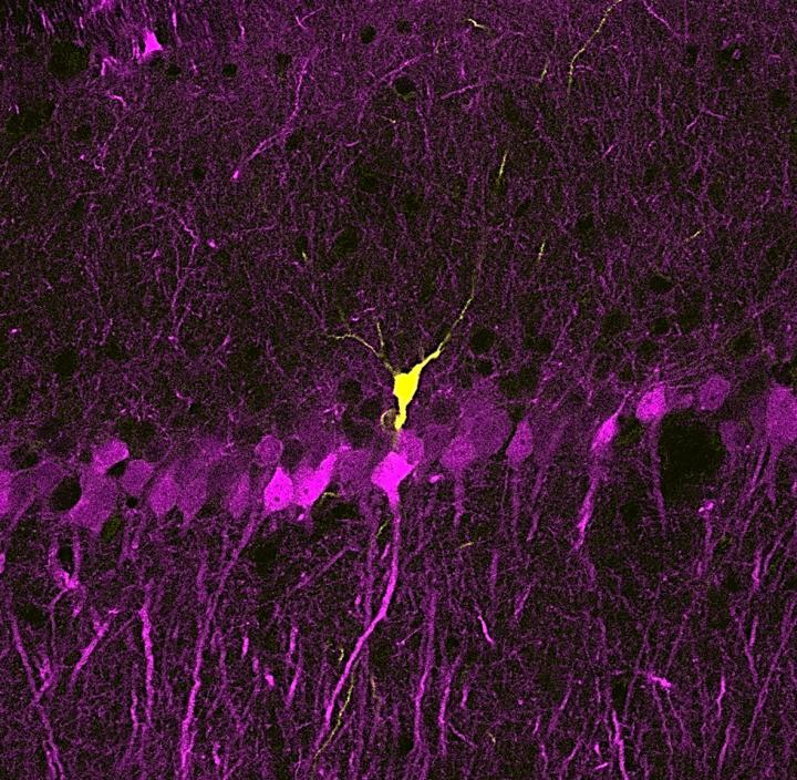 Isolated Neuron