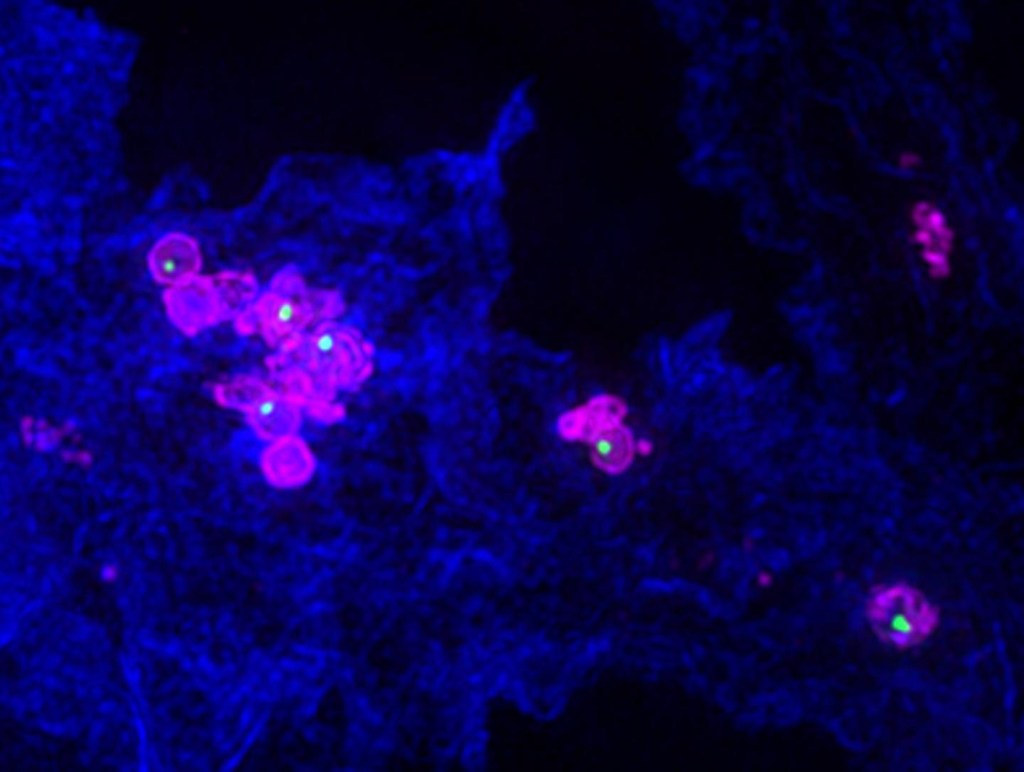 <em>Francisella novicida</em>