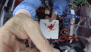 Bloodstain pattern experiments were conducted in reduced gravity aboard a parabolic aircraft