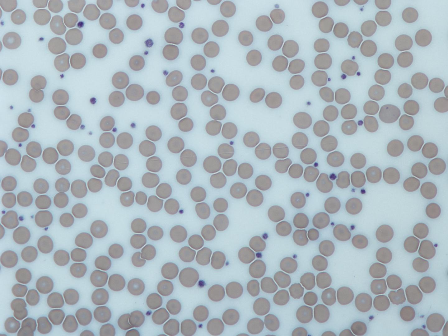 Platelets