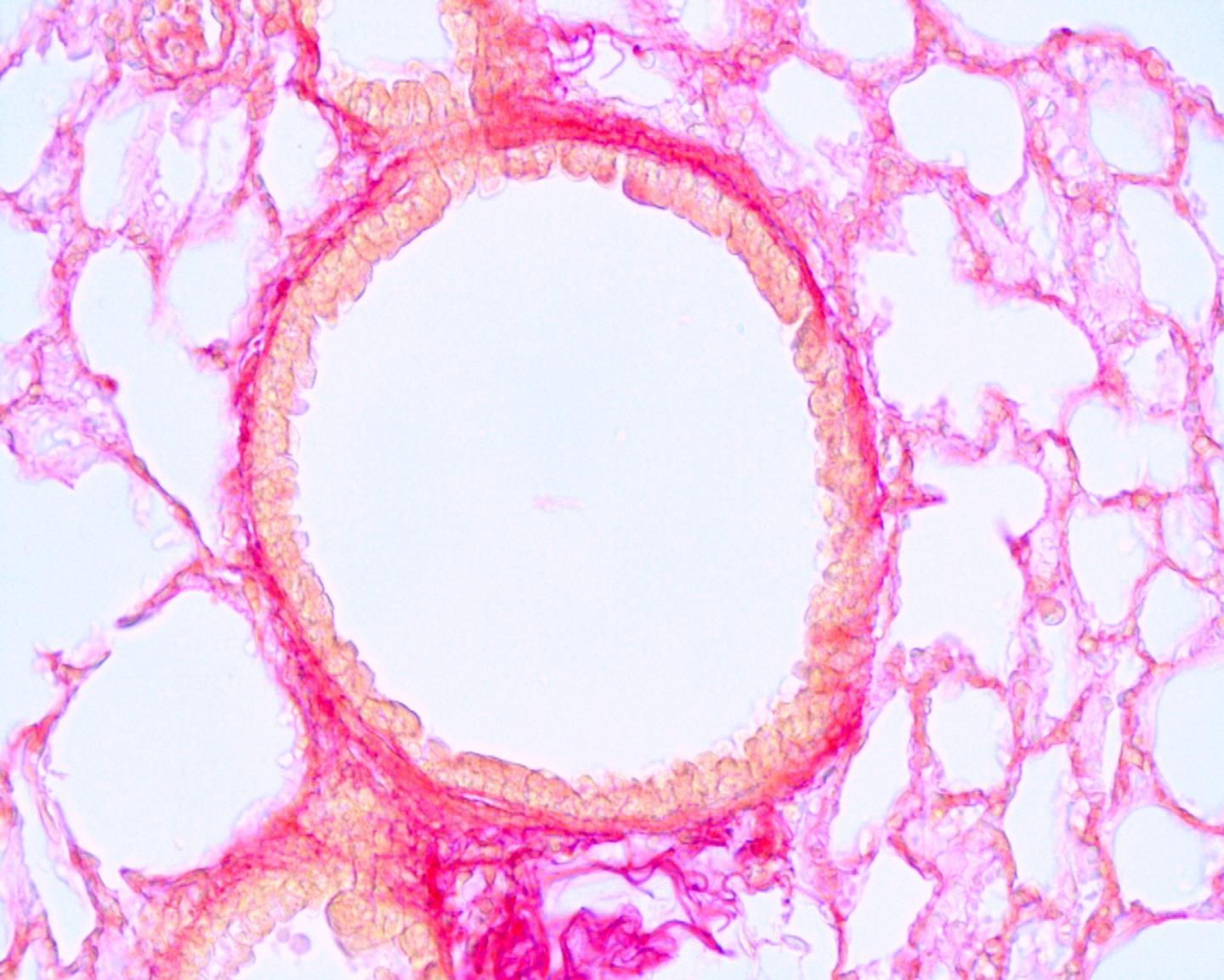 Active Pharmaceutical Ingredient