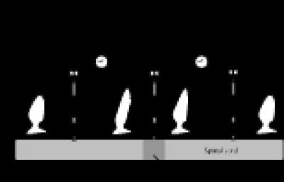 Stimulating Electrodes