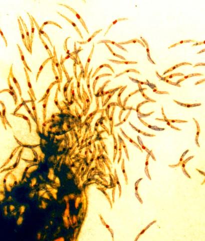 Malaria Sporozoites, the Infectious Form of the Malaria Parasite