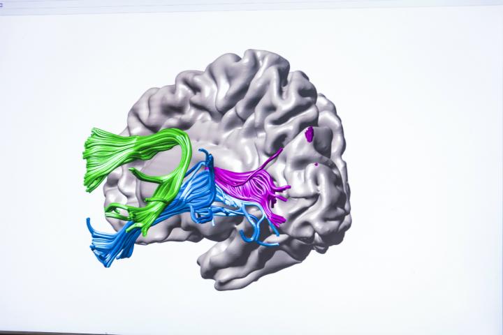 Where the Brain's White Matter Strengthened