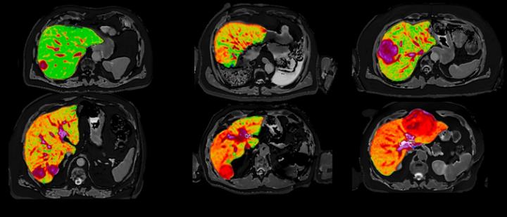 Quantitative MR images