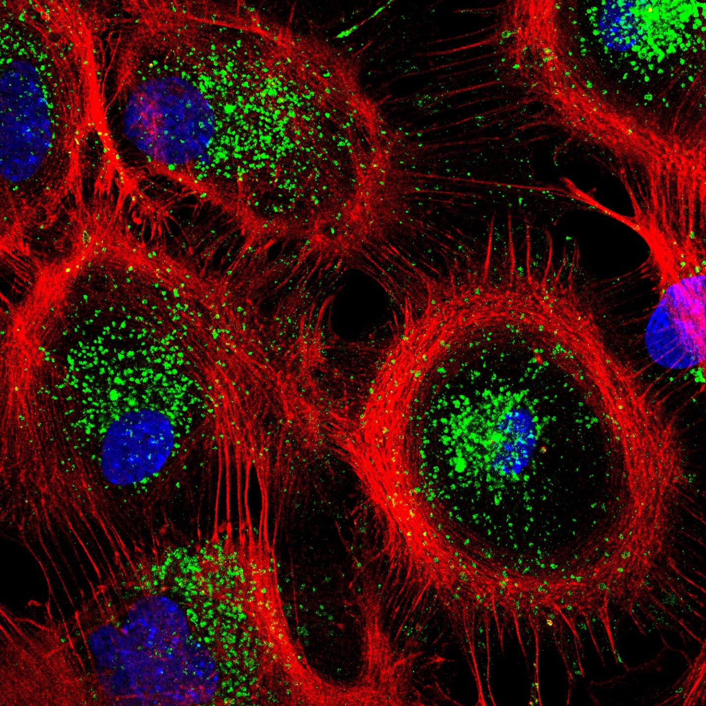 Image of mouse astrocytes showing the actin cytoskeleton (red) and lysosomes (green)