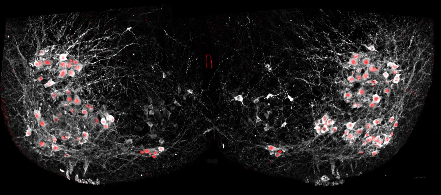 New Salk Approach Shows Motor Neurons in Real Time