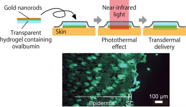 Photothermal Effect on Gold Nanorods Enhances Transdermal Drug Delivery