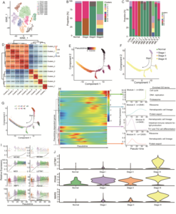 Differential gene expression modules during malignant progression.