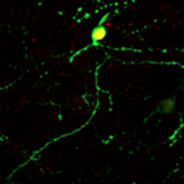 Converted Neuron