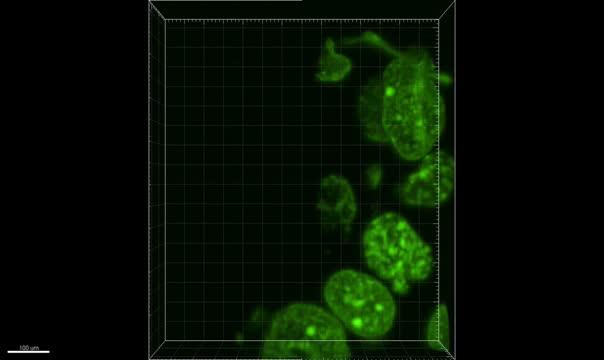 Expanded Breast Cancer Tissue with Nuclei Visualized in 3-D
