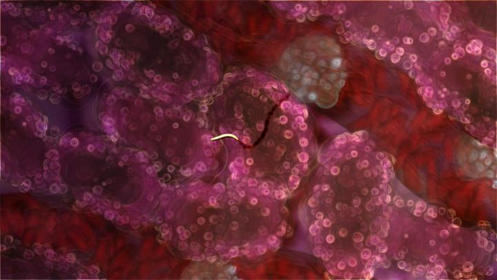 Parasite-infected Liver