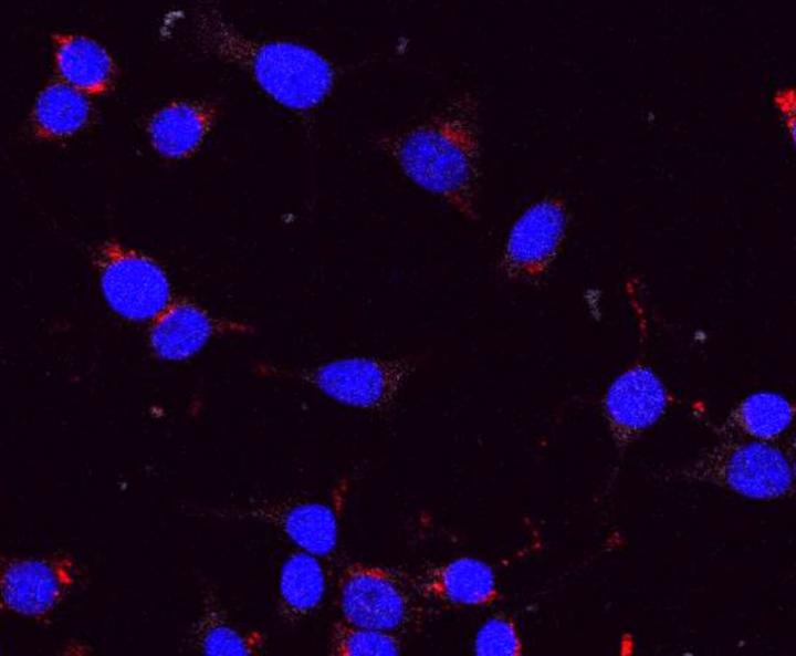 Human Beta Cells Grown in Culture
