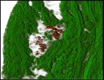 Biofilm Microcolonies