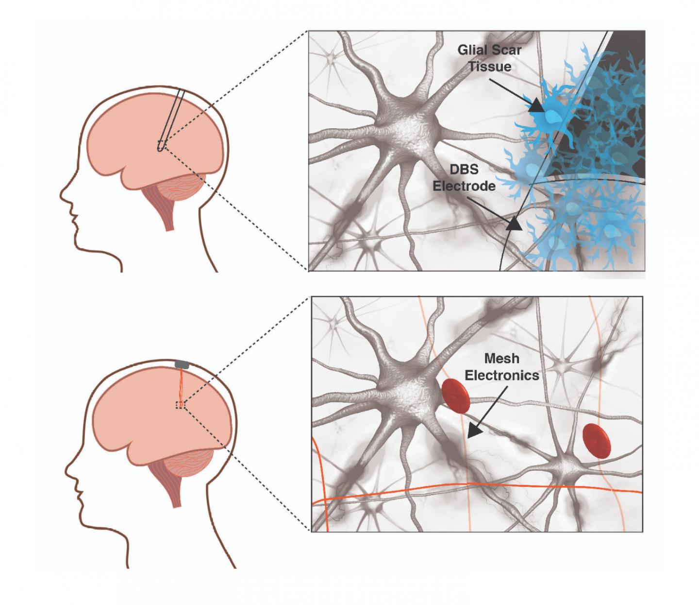 Traditional Neural Electrodes Versus Mesh Electronics