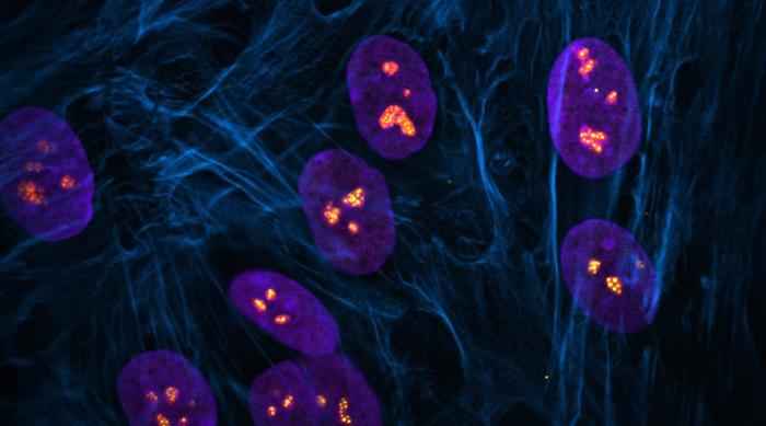 Fluorescent image showing cells with normal nucleoli in nuclei