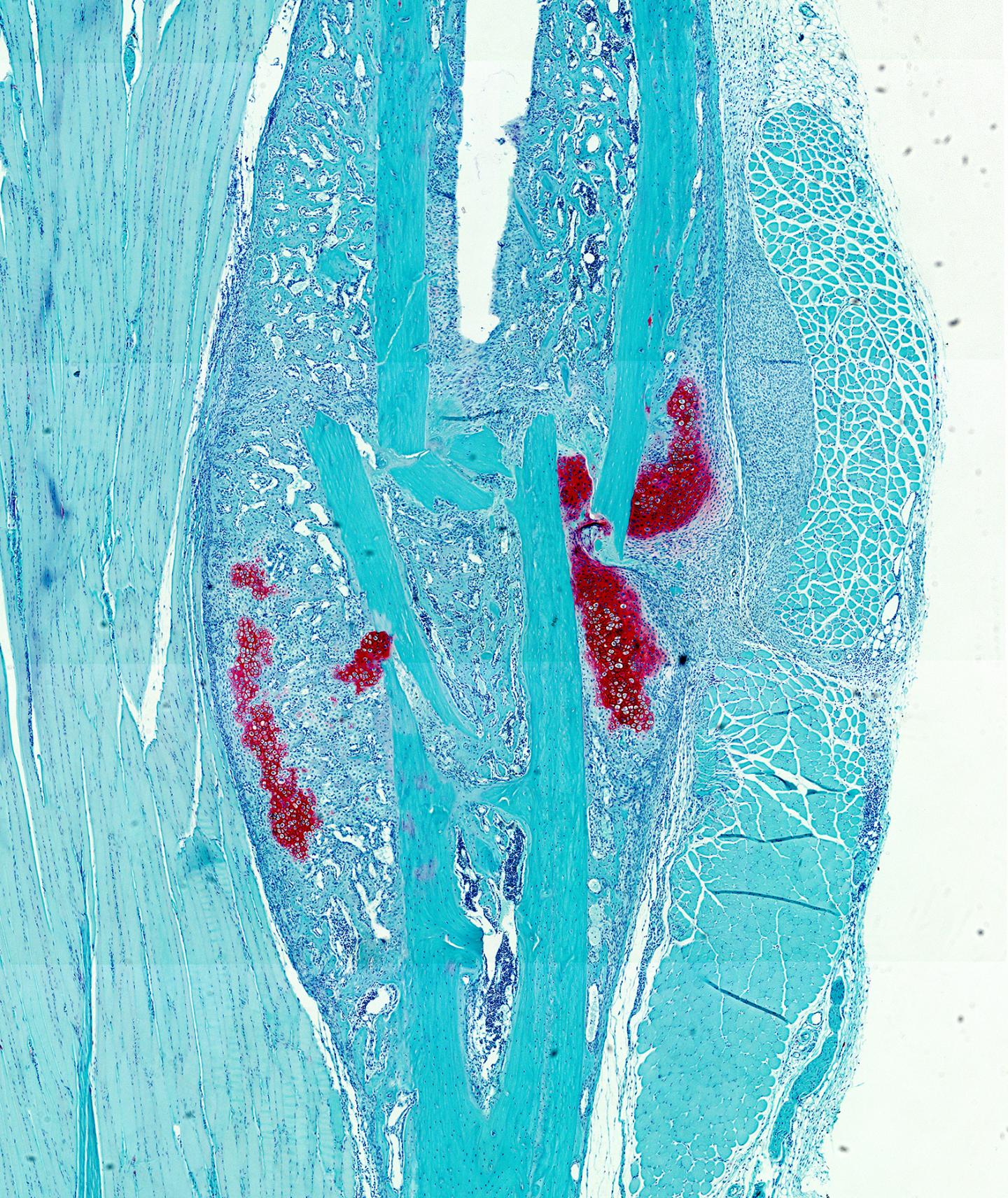 Bone or Cartilage? Presence of Fatty Acids Determines Skeletal Stem Cell Development