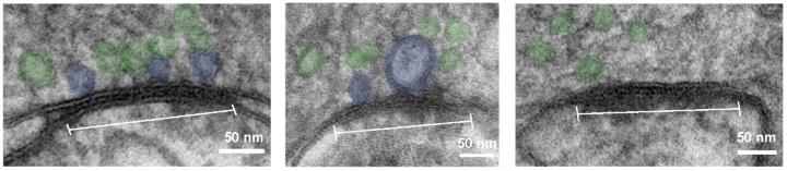 Docked Vesicles